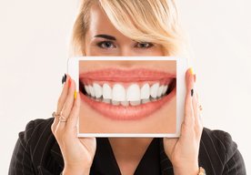 Photo Gél na báze nanočastic bieli zuby bez ich poškodenia a zároveň ich chráni pred kazom